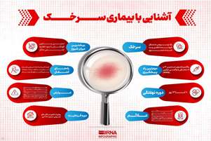 هر آنچه باید درباره بیماری سرخک بدانید